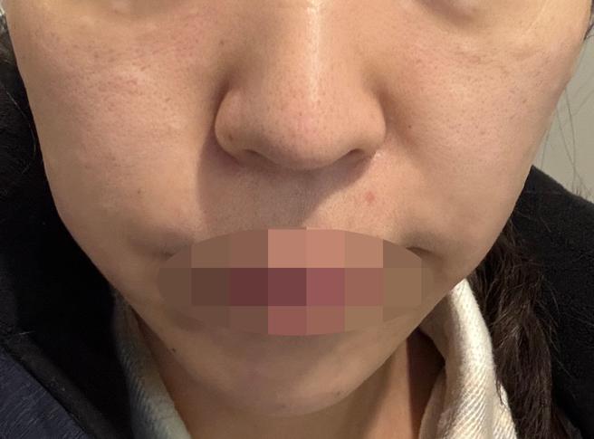 피부 처져서 써마지 받았는데 친절하고 좋은 것 같아요 ㅎㅎ