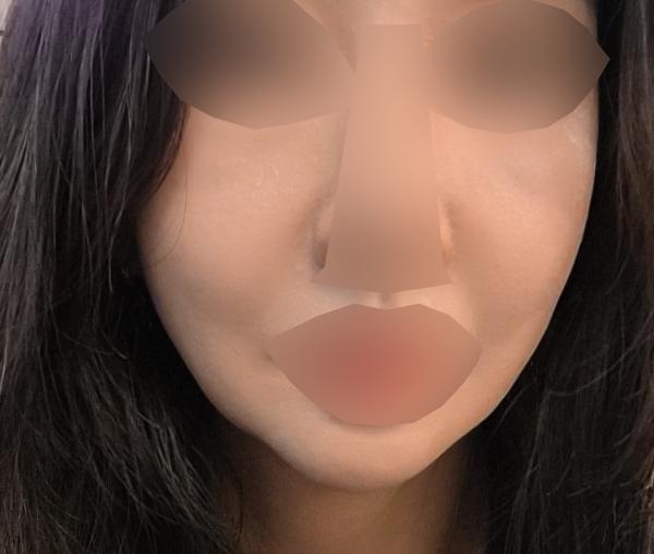 2회차인데 꼼꼼해서 한 달 후 3회차도 받으러 올 거예요 ㅎㅎ