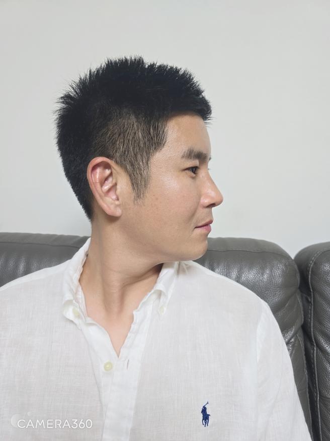 男性眼睛矫正