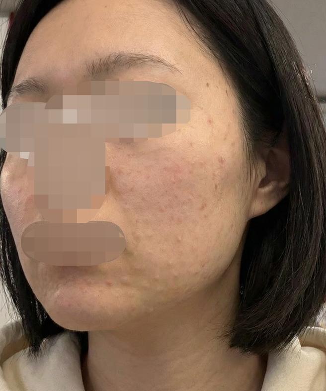 엠보 잘 남고 시설도 좋아서 여러모로 대만족이에요!!