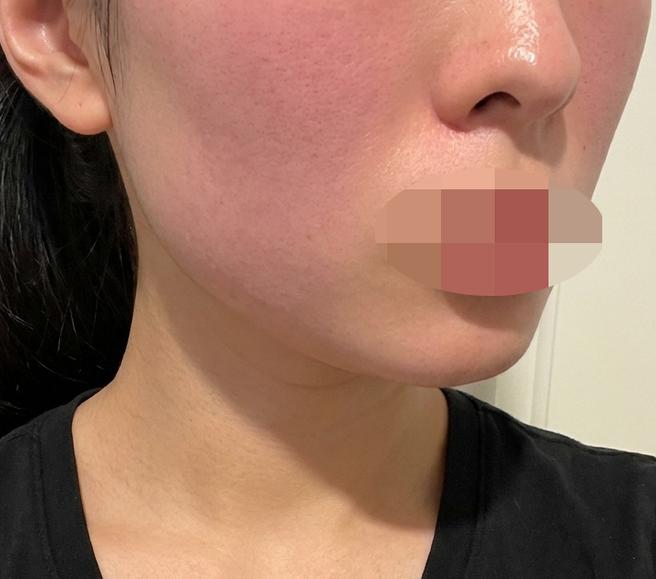 역과 가깝고 대기 짧은 곳, 남은 2회차도 여기서 받을 예정이에요