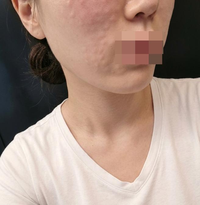 친절한 응대에 만족스러운 시술까지! 다음 달에도 또 갈게요ㅎㅎ