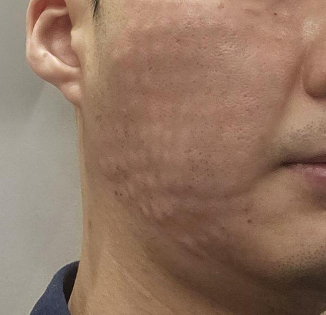 엠보 적절히 올라와서 만족, 주기적으로 받고 있습니다.