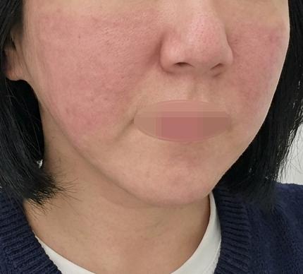 군더더기 없는 상담에 만족스러운 결과까지, 리즈네 강추예요~