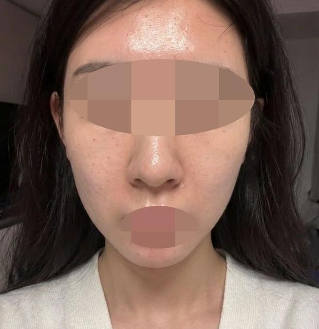 리쥬란 여기서 받았는데 엠보 확실해서 좋은 것 같아요!