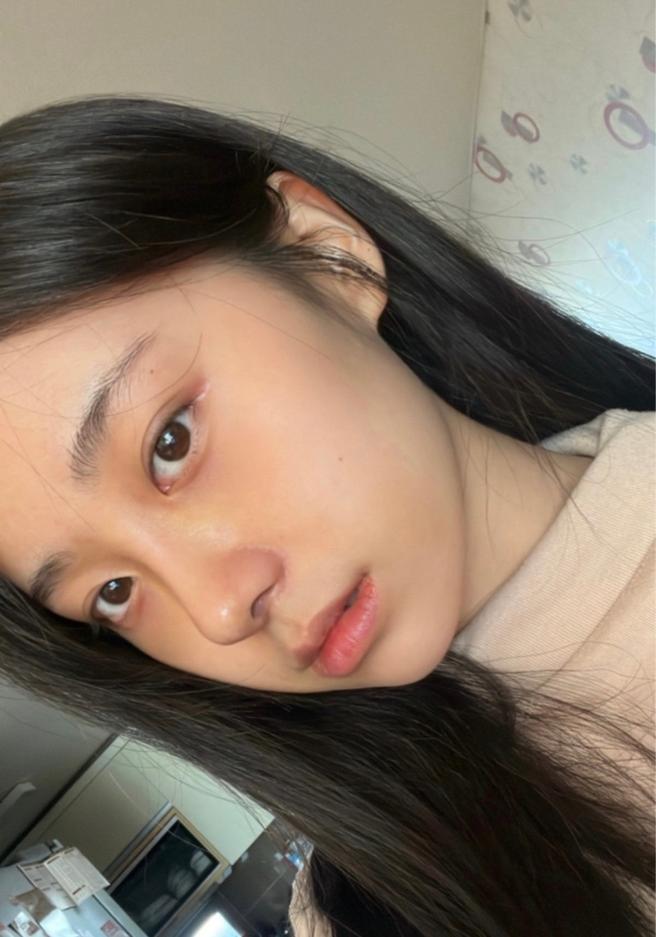 첫코성형
