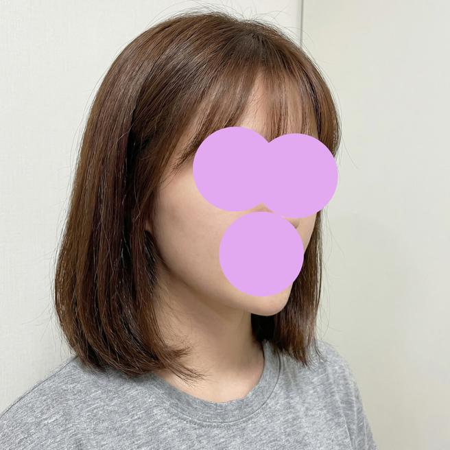 쥬베룩 맞고 일주일, 피부결 정돈 속도 실화?