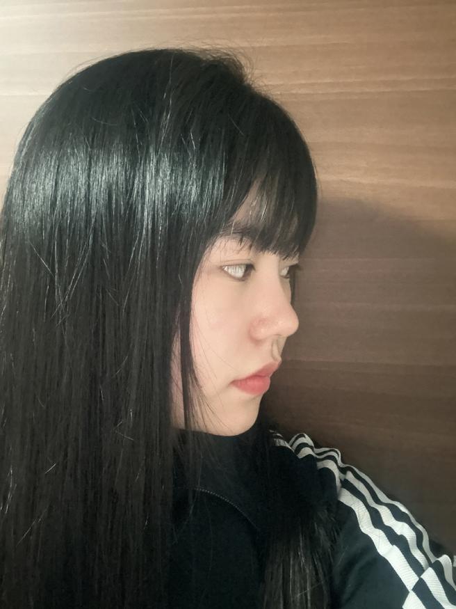 ศัลยกรรมจมูกครั้งแรก
