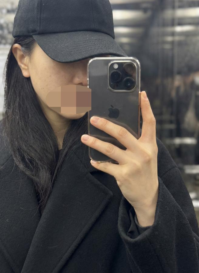 질필러 받아봤는데 다른 시술도 받아보려고요~