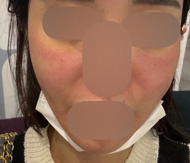 나이 들수록 필요한 리쥬란, 주기적으로 받으니 더 좋아요ㅎㅎ