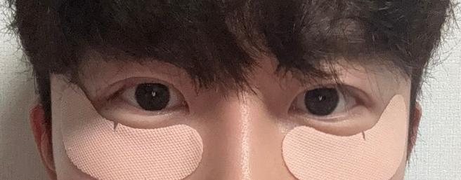 남자 눈매교정