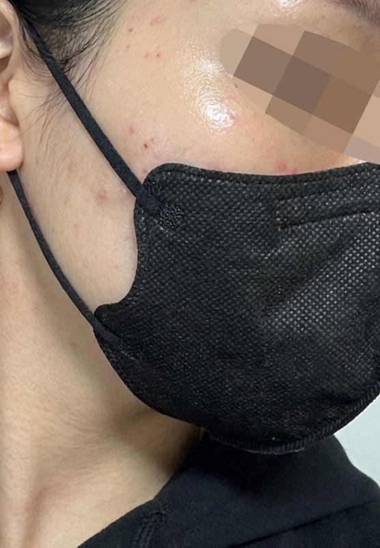 스태프분들 친절함에 통역까지 완벽해서 다음에도 꼭 다시 오려고요ㅎㅎ