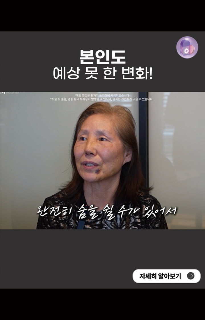본인도 예상 못 한 변화!