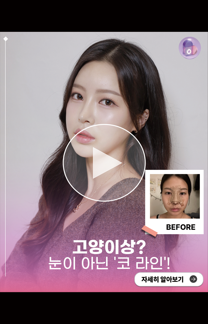 고양이상? 눈이 아닌 '코 라인'!