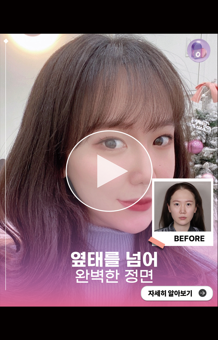 옆태를 넘어, 완벽한 정면!