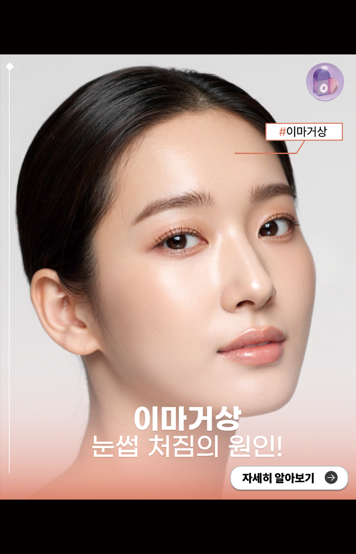이마거상 눈썹 처짐의 원인!